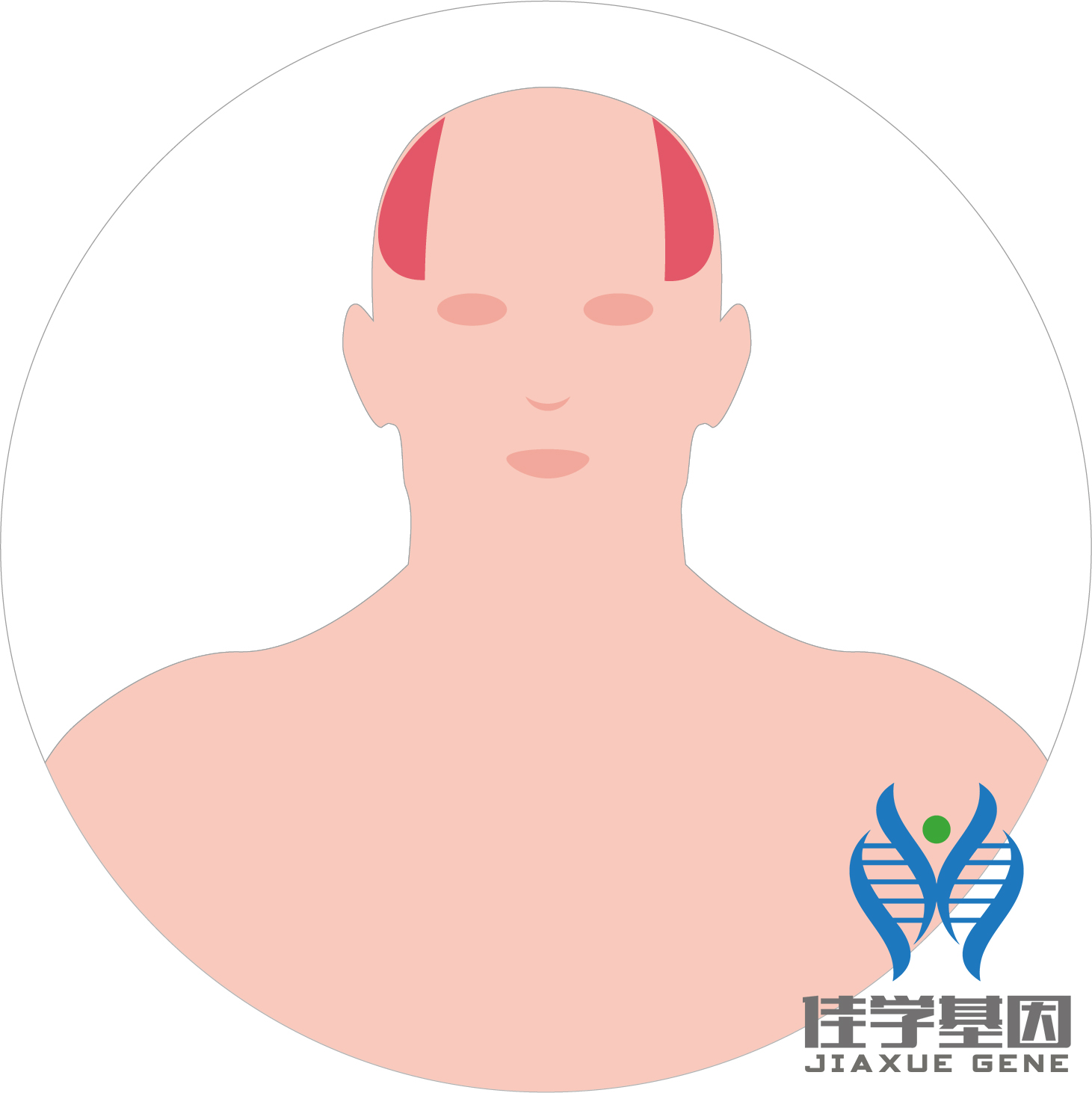 【佳學(xué)基因檢測】男性<font color='red'>脫發(fā)</font>（Androgenetic alopecia）基因解碼、<a href=http://jinzhounet.cn/tk/jiema/cexujishu/2021/31933.html>基因檢測</a>