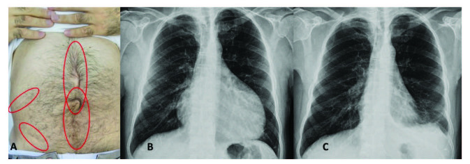 包含圖片、插圖等的外部文件。對(duì)象名稱為 turkjmedsci-50-1591-fig001.jpg