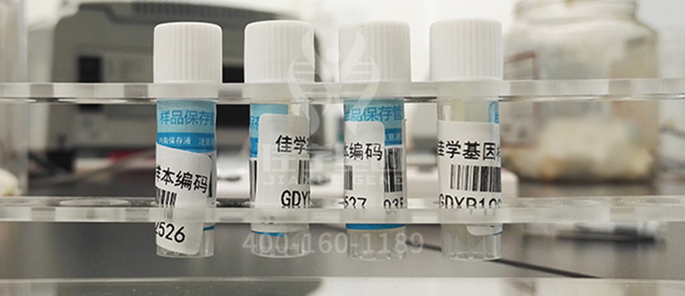 <b>【佳學(xué)基因檢測(cè)】肚子里的胎兒有三個(gè)月了，基因檢測(cè)DAG1突變，該怎么辦？</b>